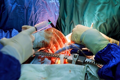 How to become a cardiothoracic surgeon